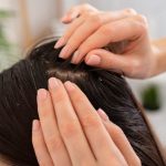 Rambut Sehat: Bersihkan Kulit Kepala Pakai Baking Soda